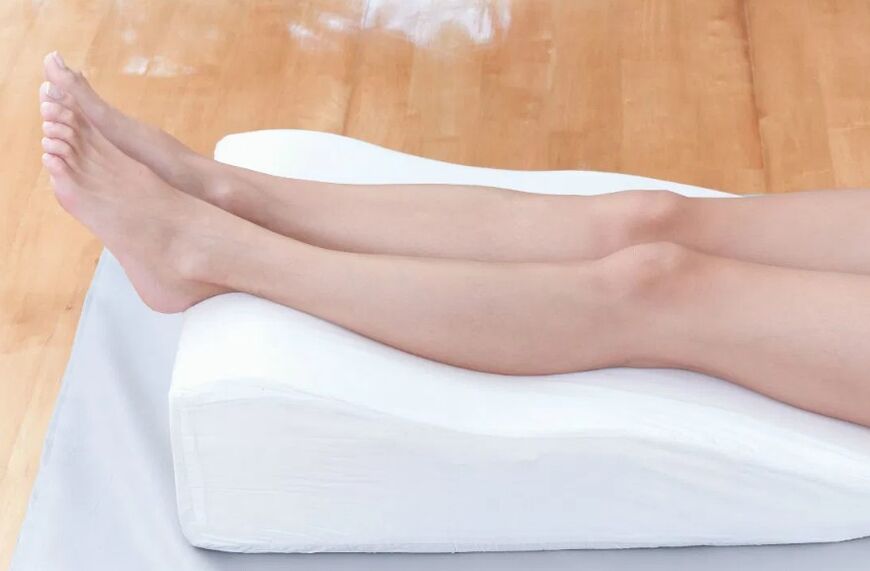 Prevention of varicose veins