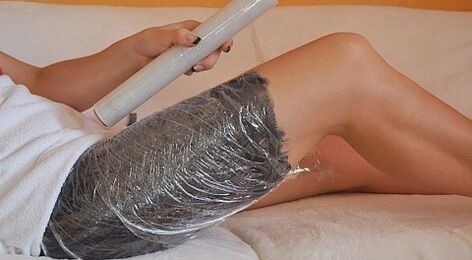 compress for treating varicose veins